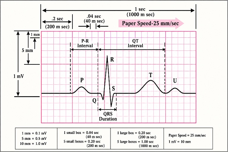 شبکه شطرنجی استاندارد کاغذ نوار قلب و امواج P، QRS، T و فواصل PR و QT