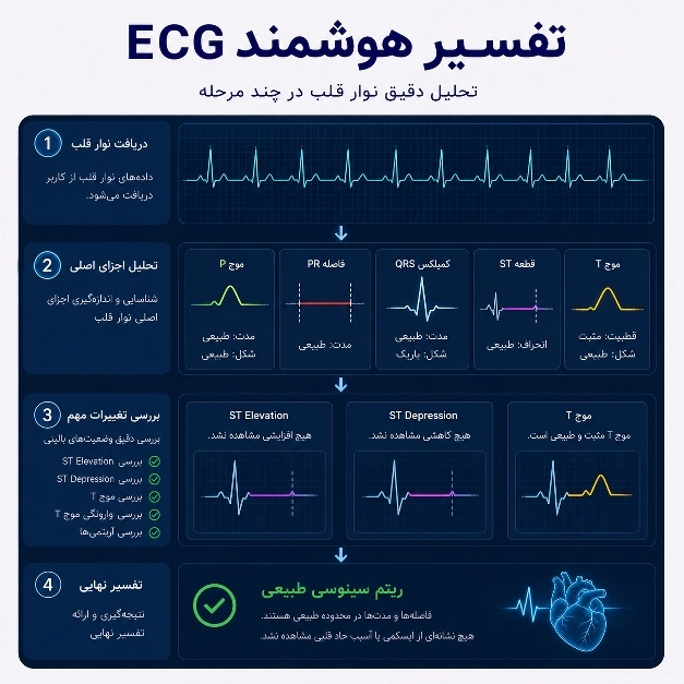 آموزش و تفسیر نوار قلب مدآپ