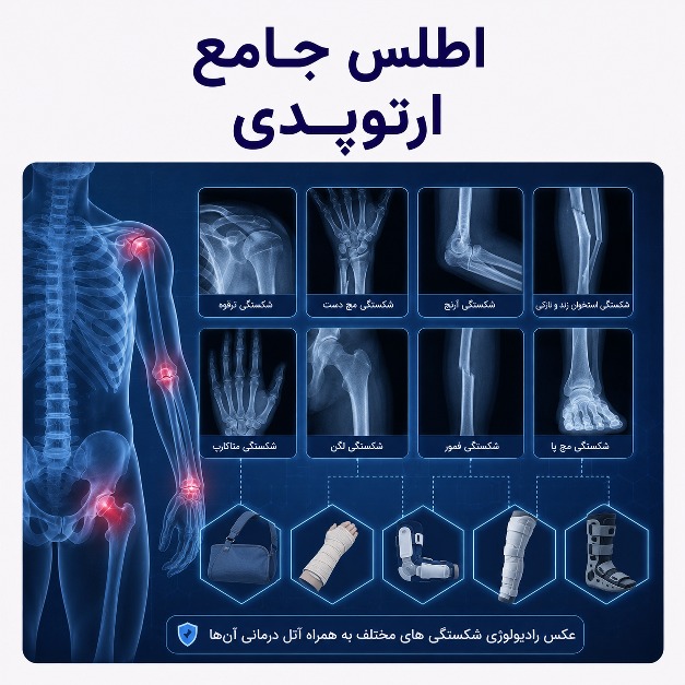 اطلس ارتوپدی و آتل‌بندی مدآپ